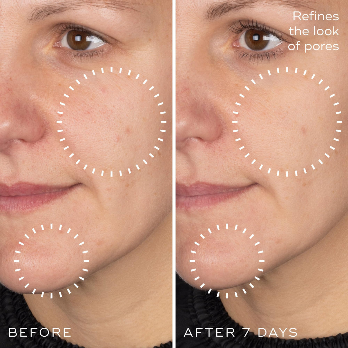 Medik8 in morning routine setting promoting balanced skin look