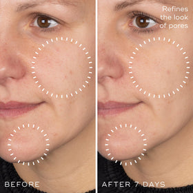 Medik8 in morning routine setting promoting balanced skin look