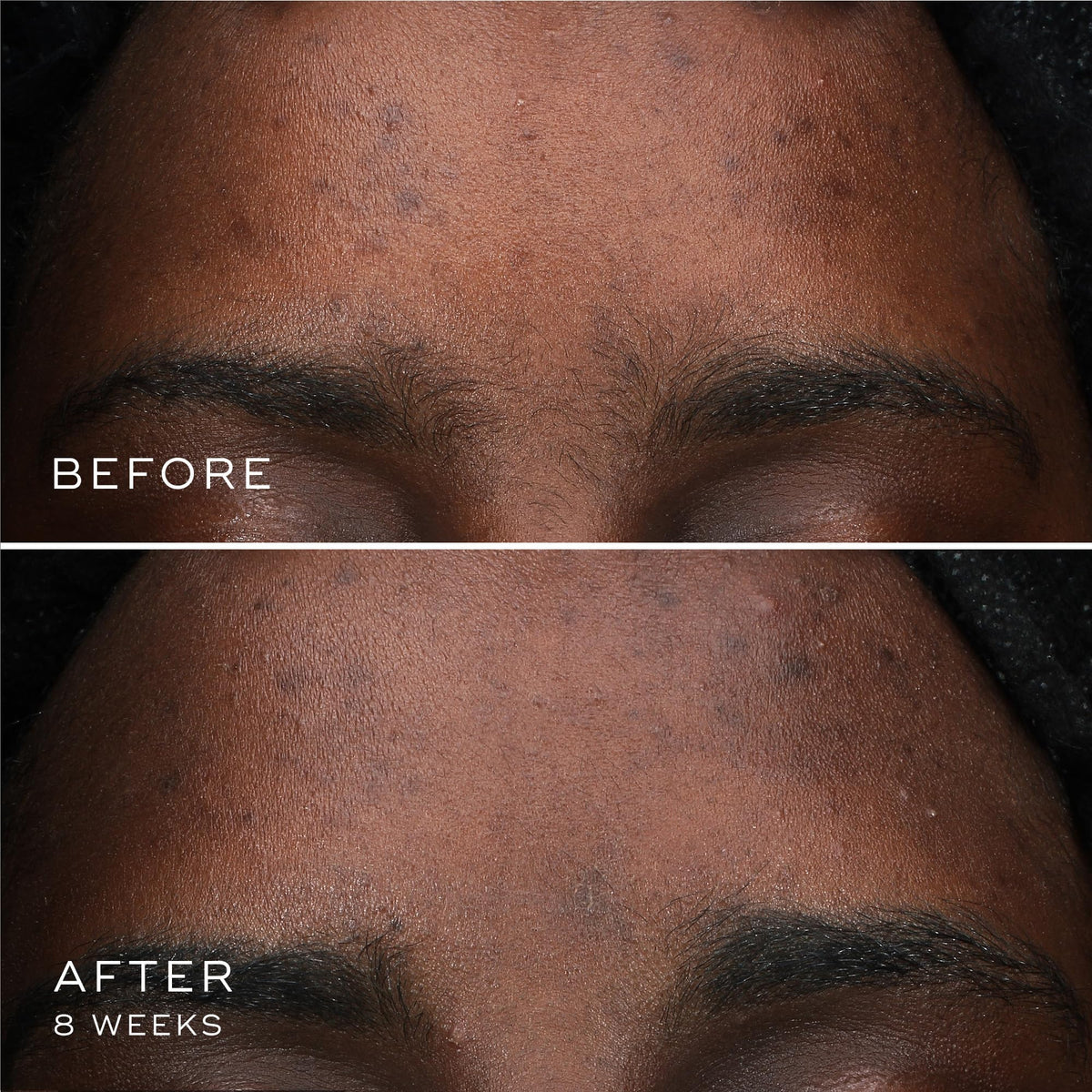 medik8 Oxy-R Peptides application on hand illustrating easy spread and layering