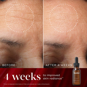 Medik8 products in hand for size comparison and easy travel-friendly benefit