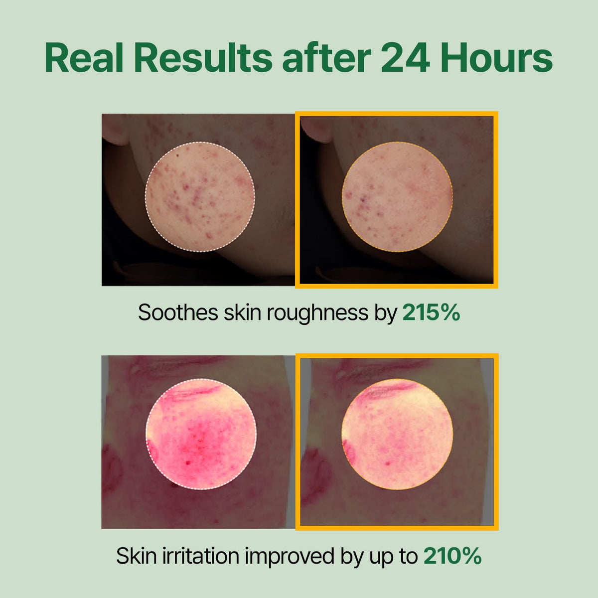 MEDITHERAPY toner soaked cotton pad used for calming compress to reduce redness