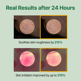 MEDITHERAPY toner soaked cotton pad used for calming compress to reduce redness