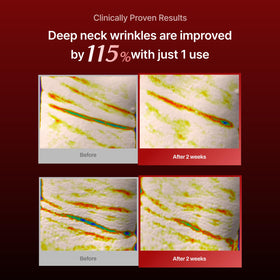 MEDITHERAPY applying neck mask on model to lift and smooth skin