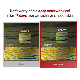 MEDITHERAPY included facial roller for enhanced ingredient penetration