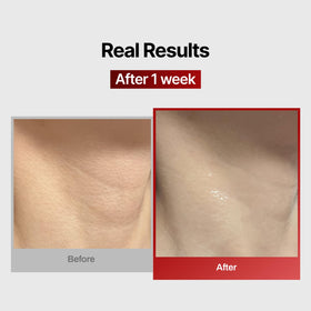 MEDITHERAPY serum texture glistening to show hydration boost