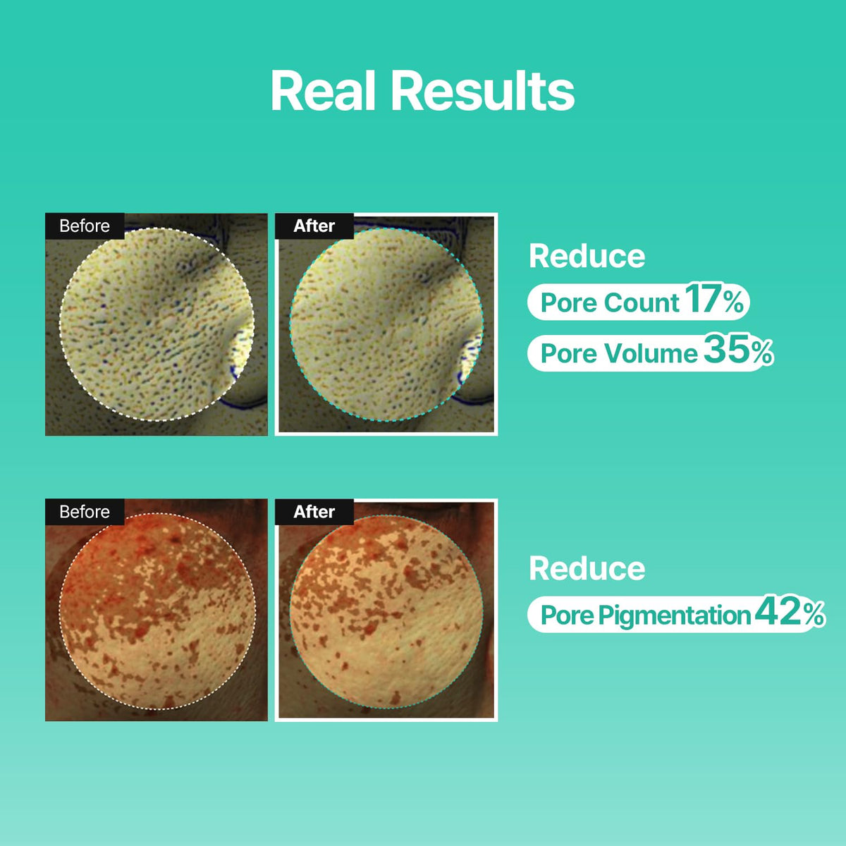MEDITHERAPY cream on hand demonstrating true-to-size 50ml jar and easy spreadability