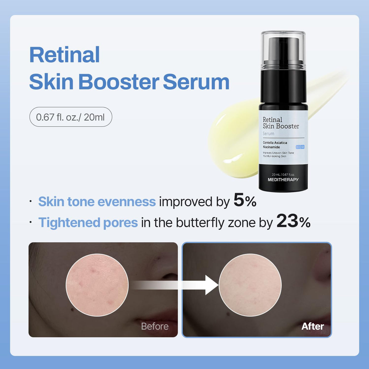 MEDITHERAPY travel-size kit inside carry-on bag for easy on-the-go skincare