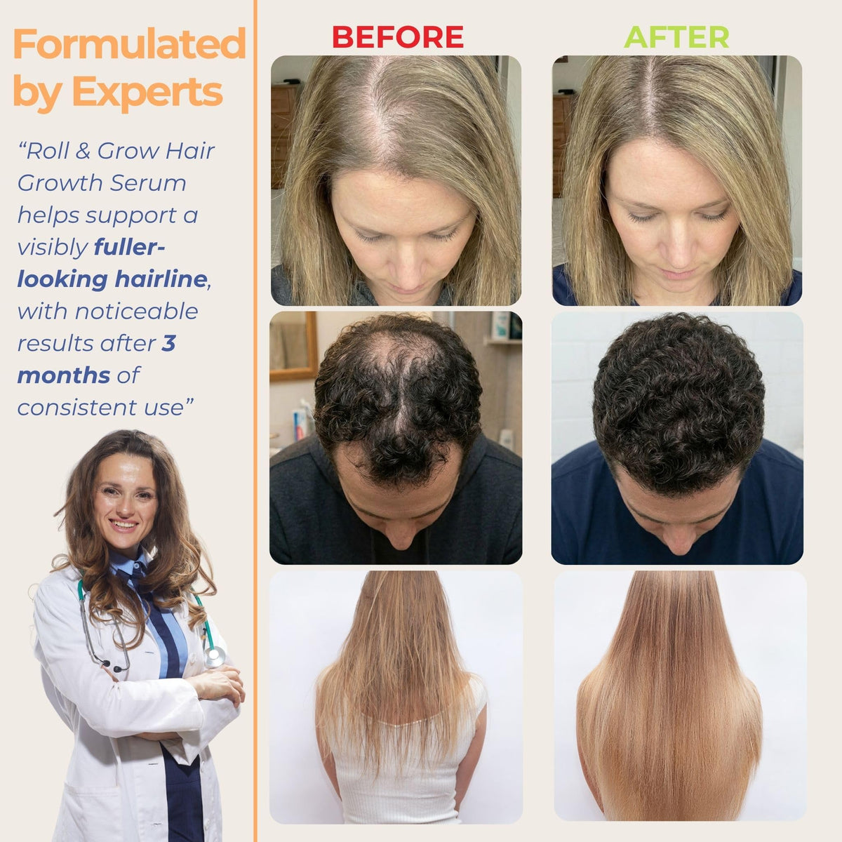 Medulla Clinic application on scalp demo showing targeted placement
