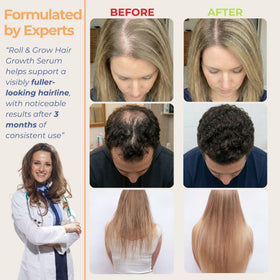 Medulla Clinic application on scalp demo showing targeted placement