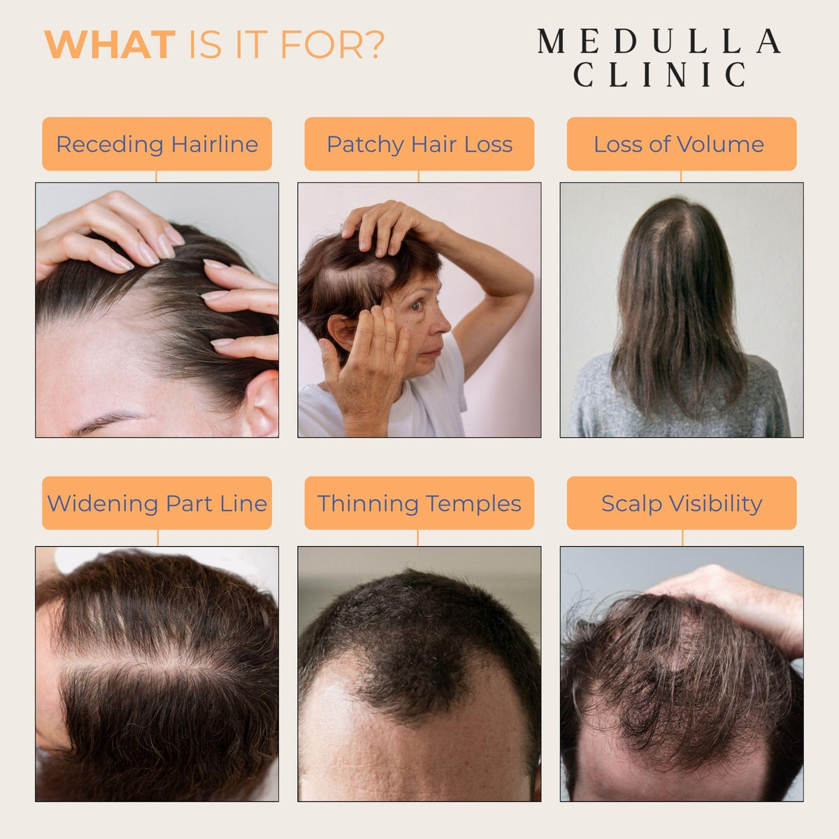 Medulla Clinic styled hair after application illustrating non-greasy volume