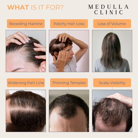 Medulla Clinic styled hair after application illustrating non-greasy volume