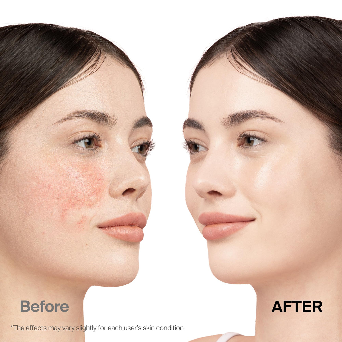 Meebak ingredient focus on centella and ceramide showing soothing benefit