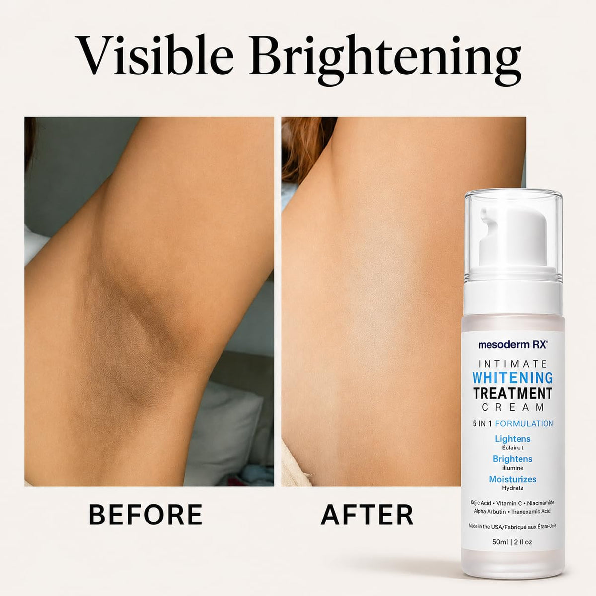 Mesoderm RX in use underarm application demonstrating gentle brightening