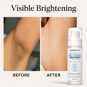 Mesoderm RX in use underarm application demonstrating gentle brightening