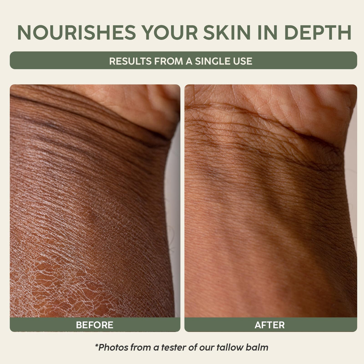 Mespok applied on hand showing quick absorption and moisturized skin