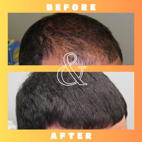 Mettle Mane solution texture on pipette demonstrating lightweight absorption benefit