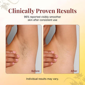 Metyou bottle with Cyperus roots visual highlighting botanical ingredient benefit