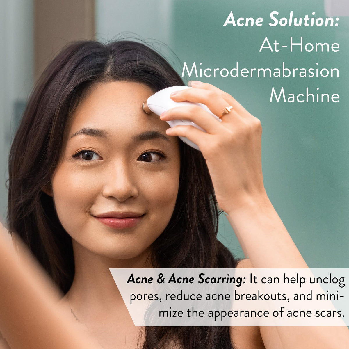 Microderm GLO accessories and kit laid out for complete at-home treatments