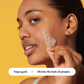 Mighty Patch applied on forehead demonstrating secure, flexible fit