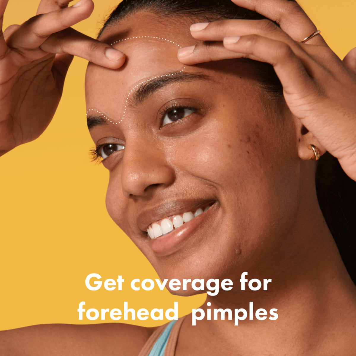 Mighty Patch forehead close-up texture showing smooth hydrocolloid surface that absorbs fluid