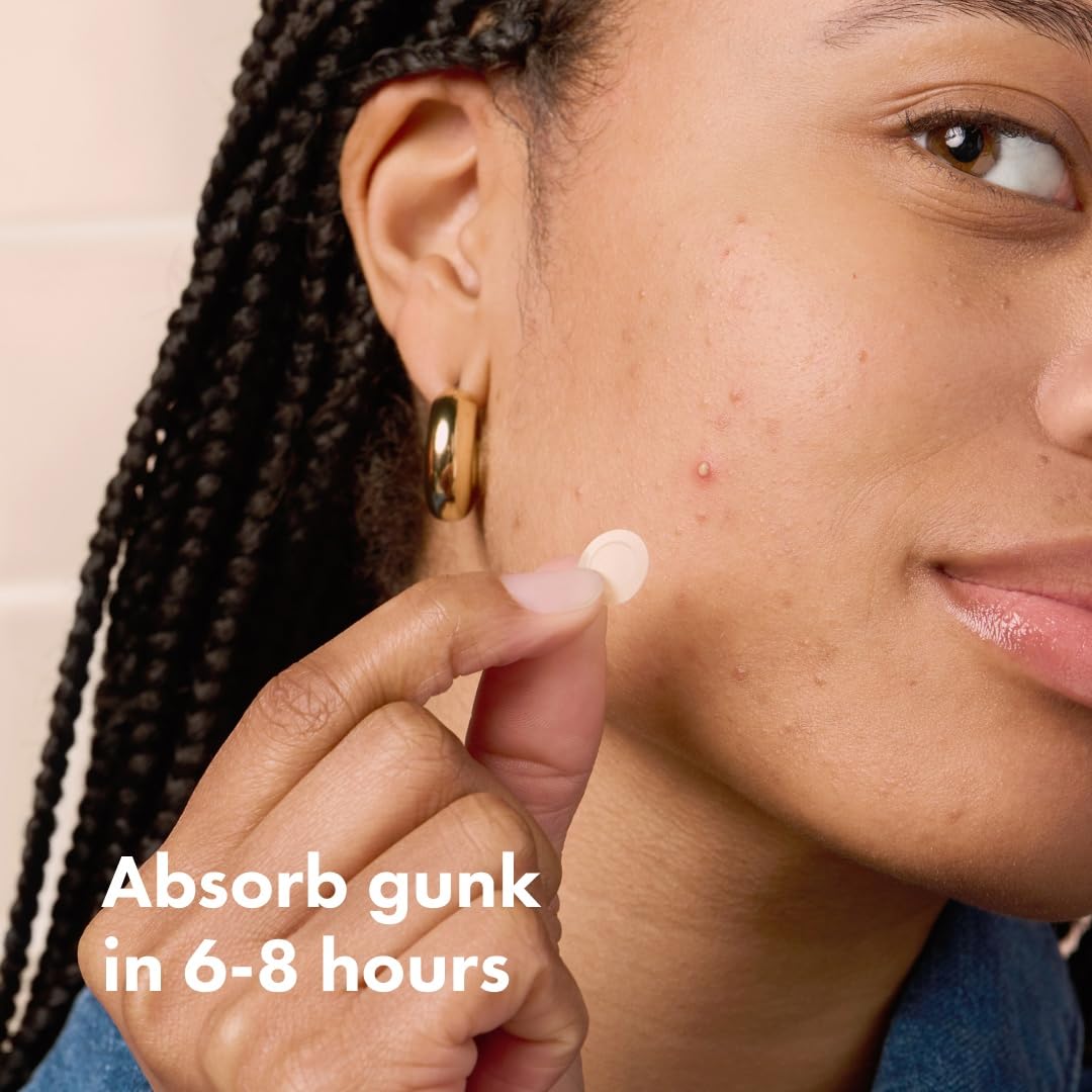 Mighty Patch Invisible+ applied on cheek demonstrating daytime concealment benefit