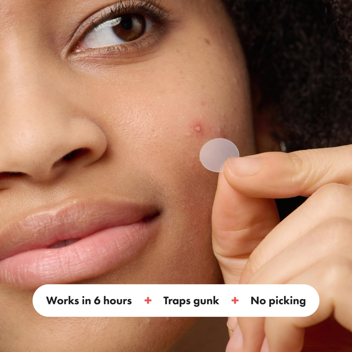 Mighty Patch applied on face demonstrating discreet protection and healing