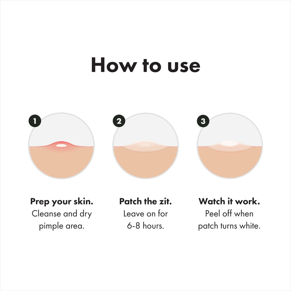 Mighty Patch covering back acne cluster demonstrating body-use protection