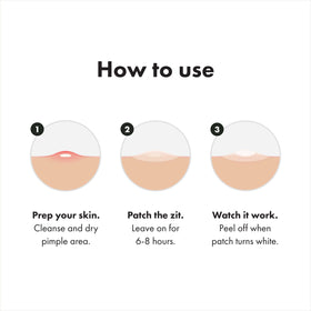 Mighty Patch covering back acne cluster demonstrating body-use protection