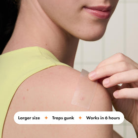 Mighty Patch applied to jawline showing secure fit and coverage benefit