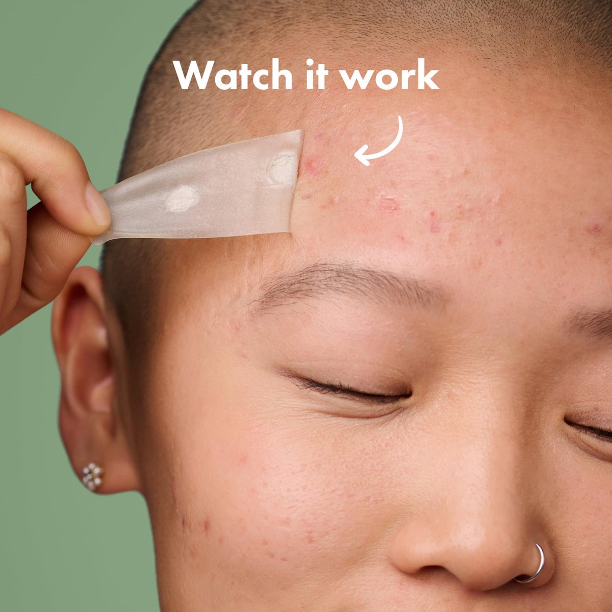 Mighty Patch texture detail highlighting hydrocolloid surface and absorption