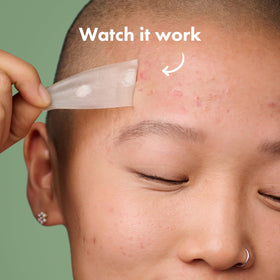 Mighty Patch texture detail highlighting hydrocolloid surface and absorption