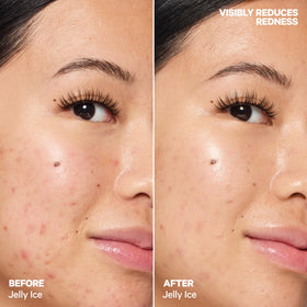Milk Makeup tucked in a travel pocket highlighting portability and on-the-go relief benefit