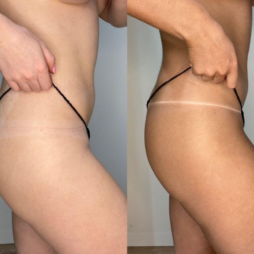 MINETAN BODY.SKIN 33.8 fl oz bottle shown for size and treatment quantity