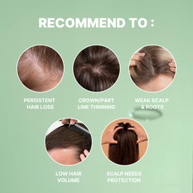 MINOXELL close-up label highlighting biotin and panthenol for targeted scalp support