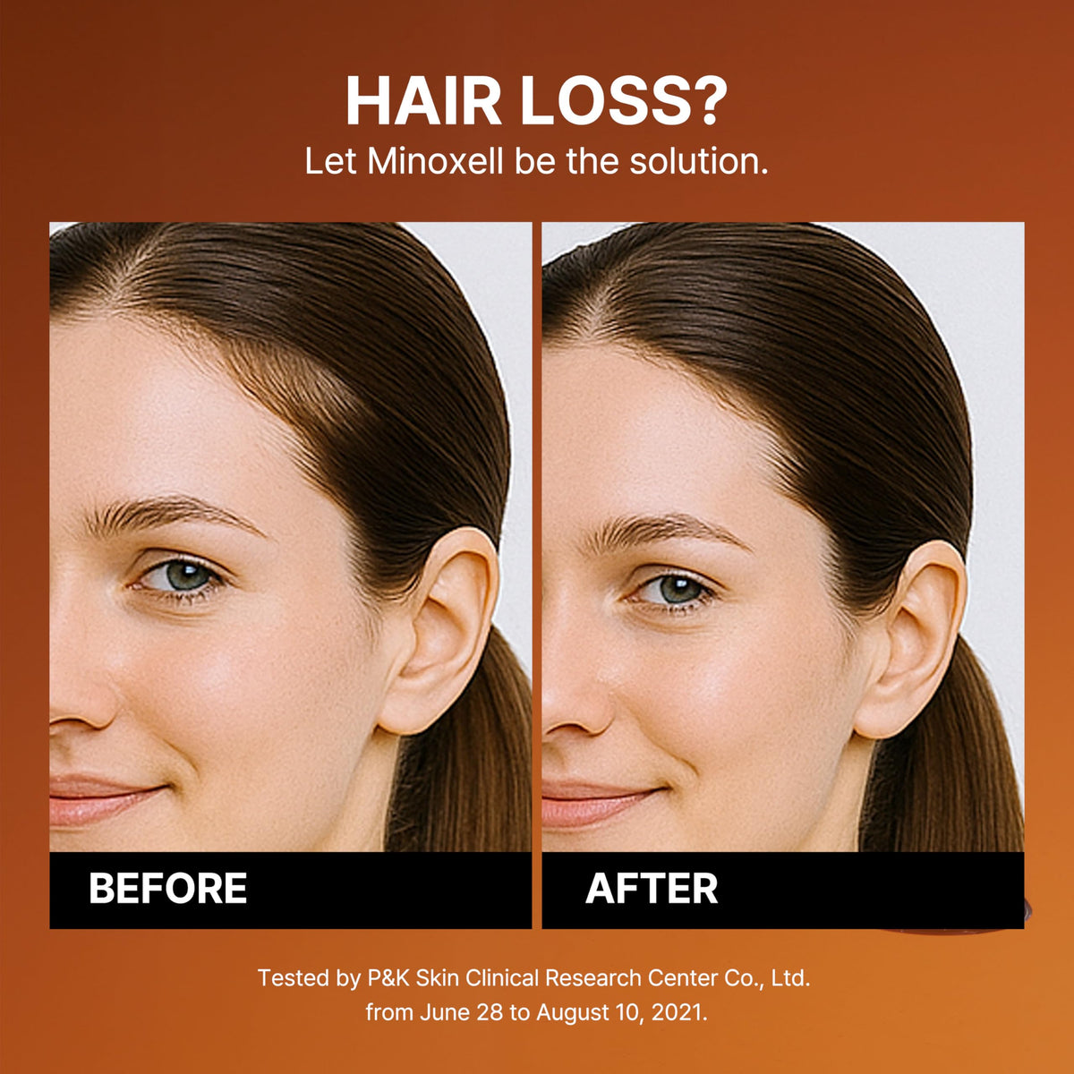 MINOXELL biotin and peptide ingredient display highlighting nourishment