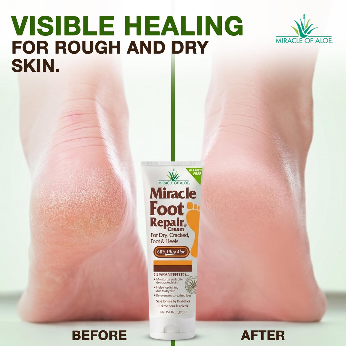Miracle of Aloe two-pack stacked to show value and convenient backup supply