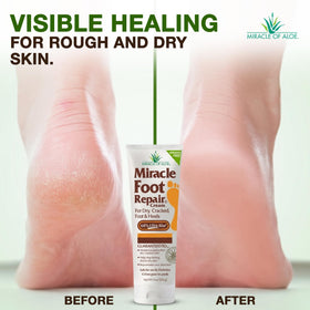 Miracle of Aloe two-pack stacked to show value and convenient backup supply