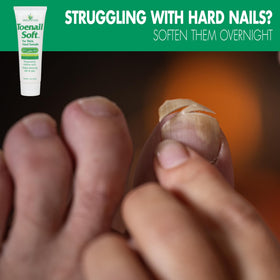 Miracle of Aloe before and after nail softening showing neater nails