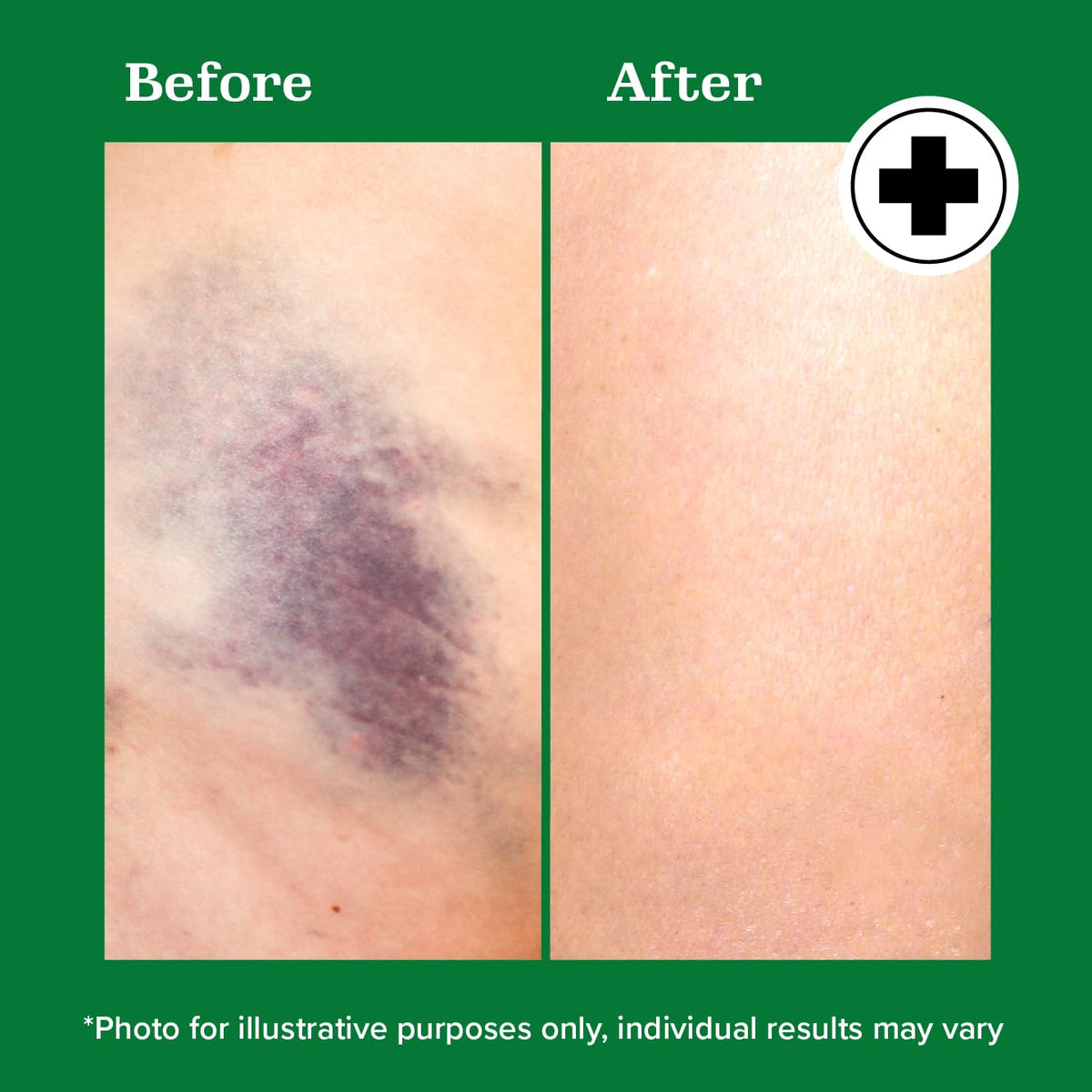 Miracle Plus applied post-sport by athlete showing calming support benefit
