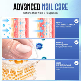 Miratiful applied to a toenail demonstrating targeted softening benefit