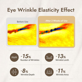 MIZON eye cream next to ruler showing compact 0.84 oz travel-friendly size