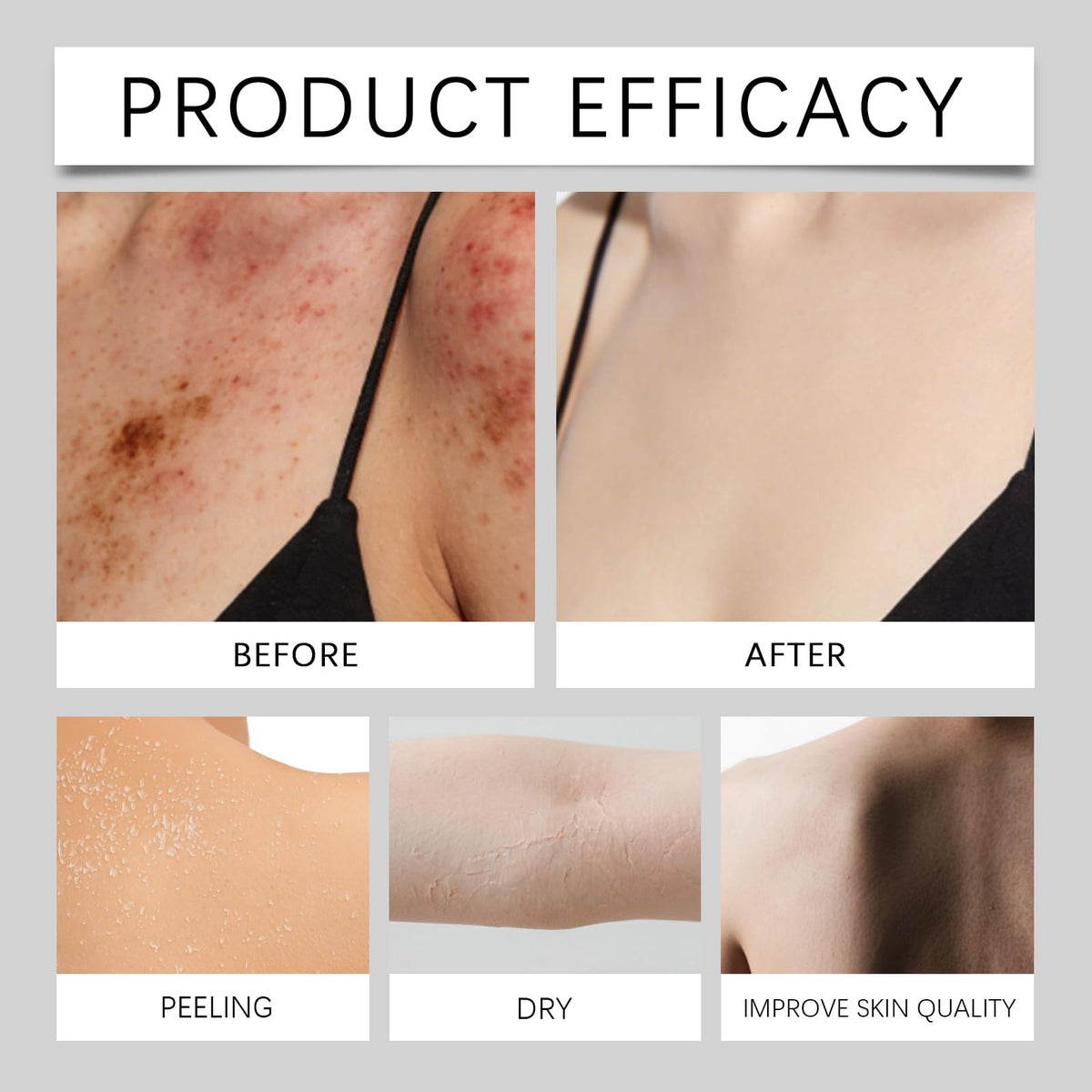 MMGRZR suds on shoulder showing gentle cleansing and oil removal benefit