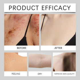 MMGRZR suds on shoulder showing gentle cleansing and oil removal benefit