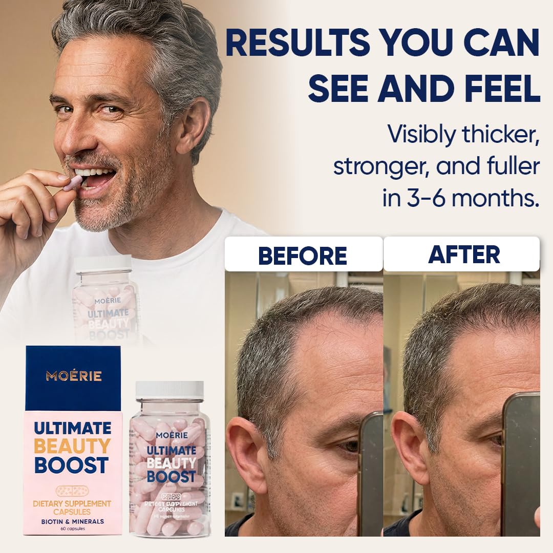 Moerie open capsule with visible beadlets, demonstrates easy-to-swallow design