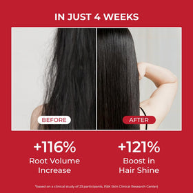 MOEV lather on scalp illustrating gentle cleansing and debris removal