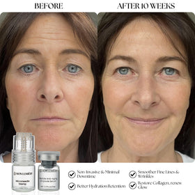 Mon Lumière stamping on cheek in use showing targeted infusion for visible radiance