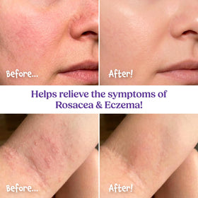 moomade used in nighttime skincare routine promoting restorative moisture