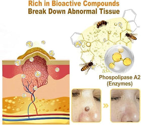 MORKORIA applying cream to wart on finger demonstrating targeted treatment
