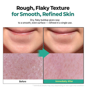 MOTHER MADE before and after face image showing refined texture and brighter skin