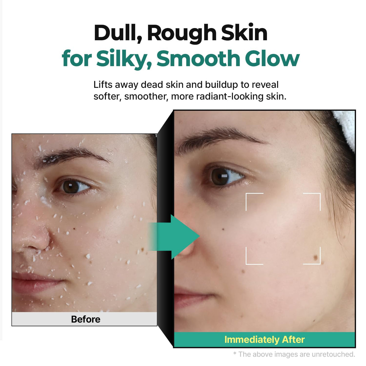 MOTHER MADE before and after forehead smoothing demonstrating improved texture